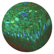 Optical coherence tomography